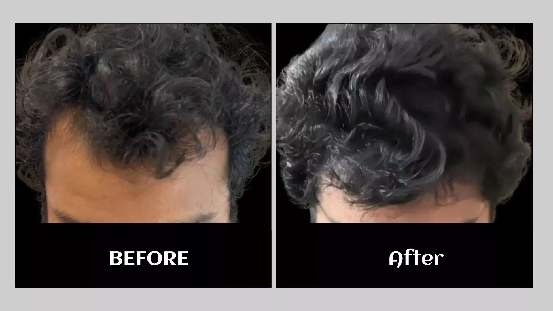 before-1-68a2cfd2bea1c