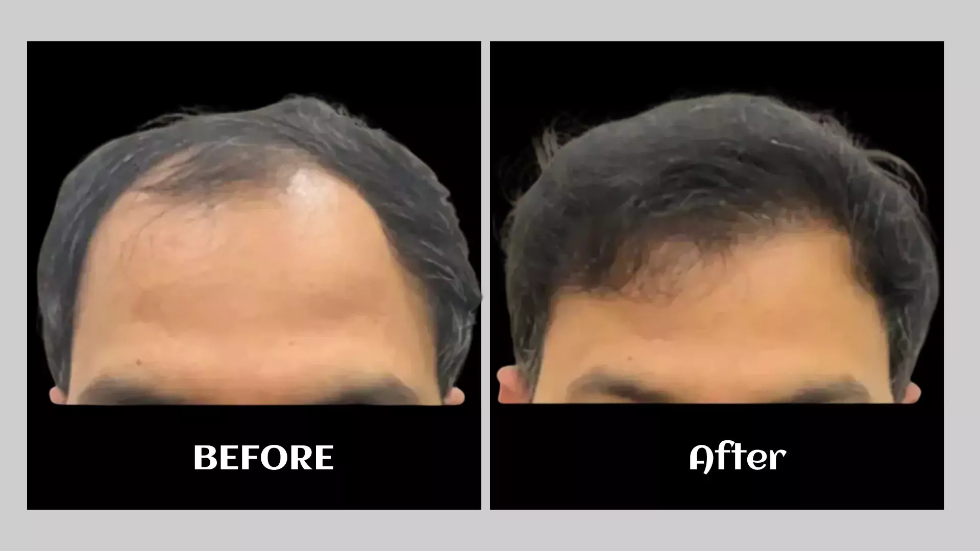 before-2-68a2cfd2a38e8