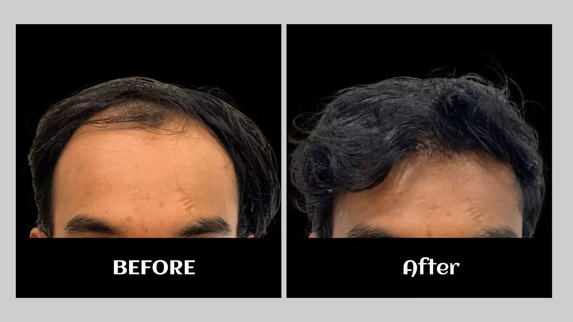 before-68a2cfd8014fb